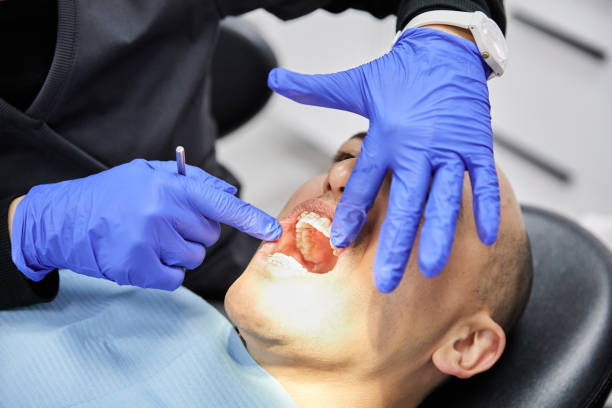 Best Urgent Tooth Repair  in Catawba, SC